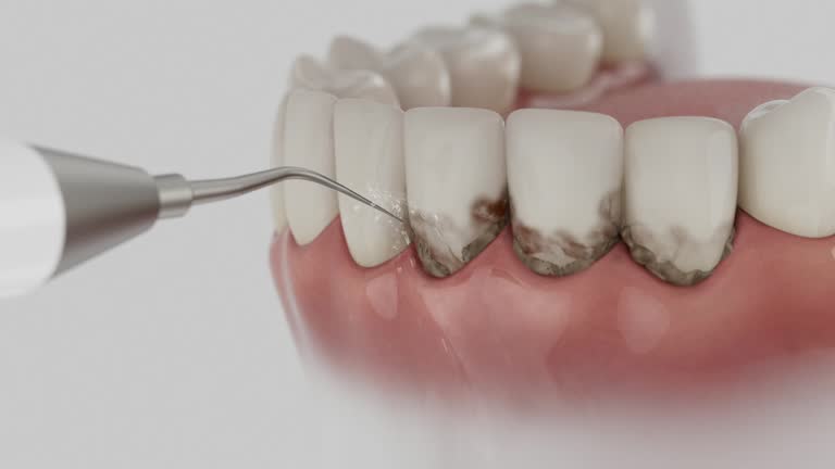 Reliable Dental Implants contractor in Alice, TX by Smile Center Dentistry
